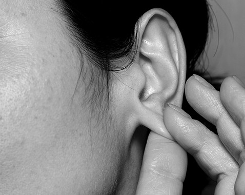 Torn ear lobes